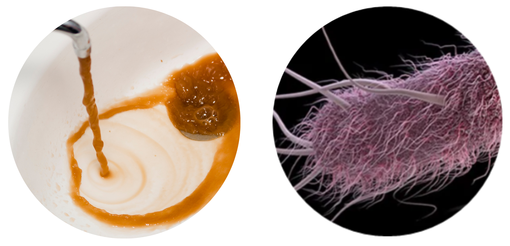 Dirty water - biofouling